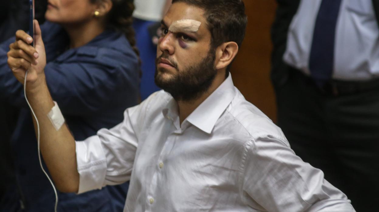 El opositor venezolano Juan Requesens tras recibir una golpiza.