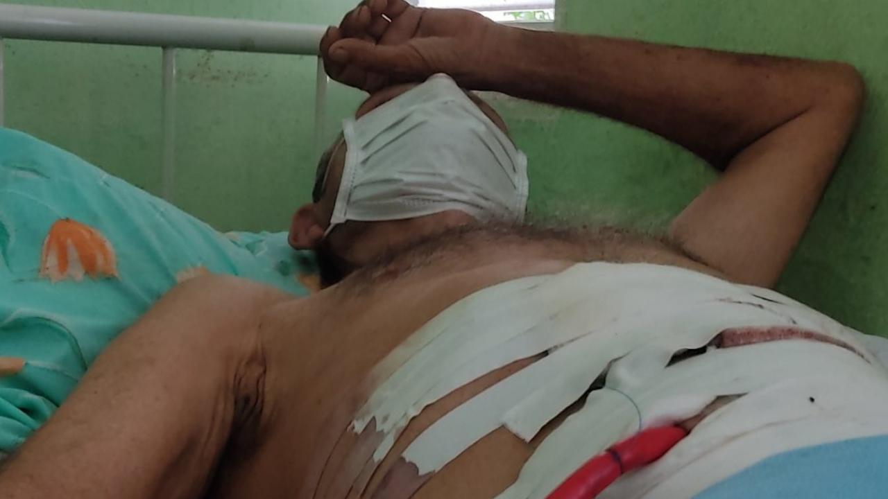 El cubano apuñalado durante su recuperación en el hospital.