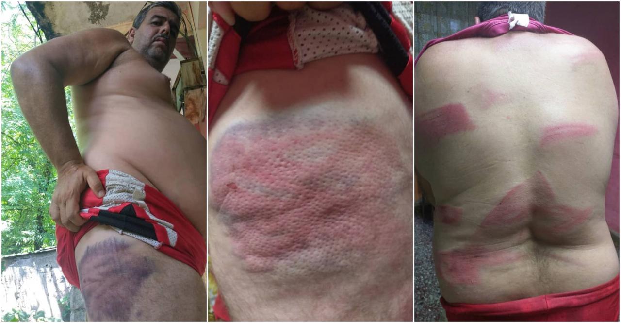 El opositor cubano Heriberto Pons muestra las lesiones tras un ataque con un bate.