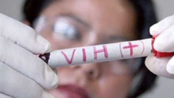 Una doctora sostiene un test de VIH.