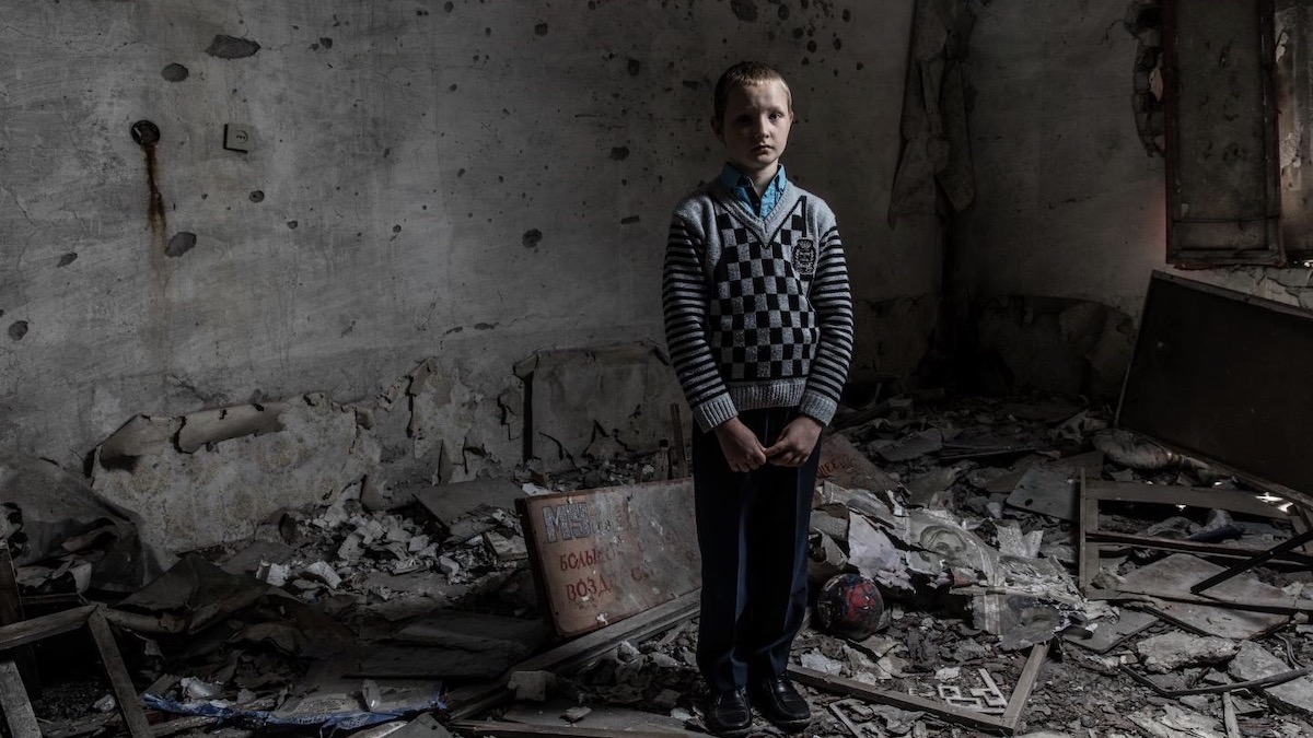 Un niño ucraniano, víctima de la invasión rusa.