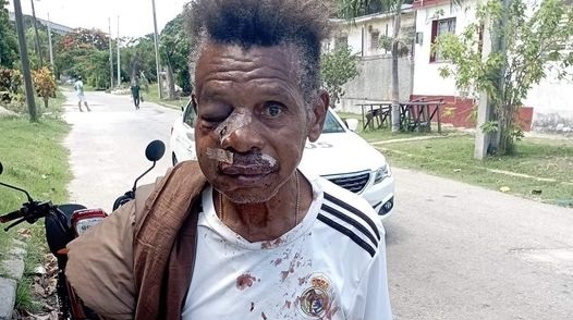 Gonzalo, el custodio que fue golpeado durante el robo de tres motorinas en La Habana.