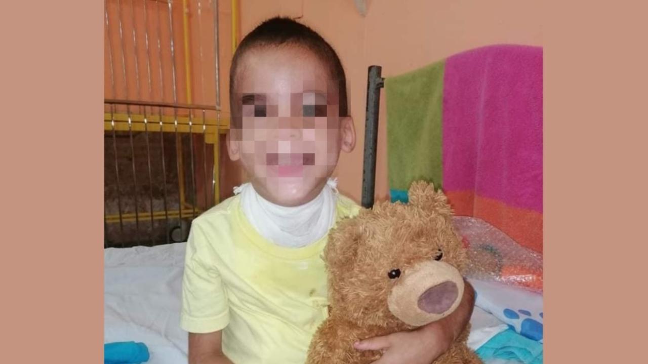 Madre cubana pide bolsas de colostomía para su niño de cuatro años