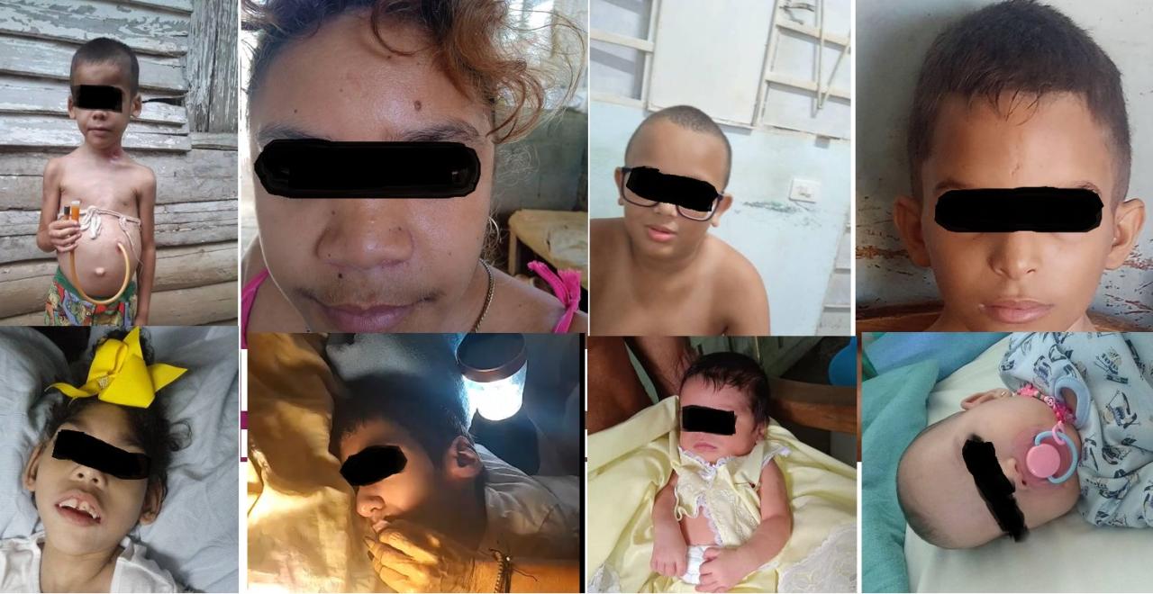  Sick Cuban Children whose ailments are not being treated by the Cuban Public Health System.
