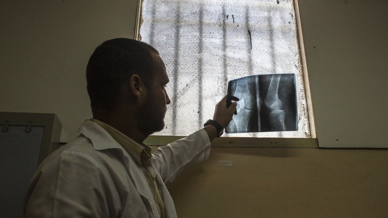 Un médico mira una radiografía en un hospital de La Habana.