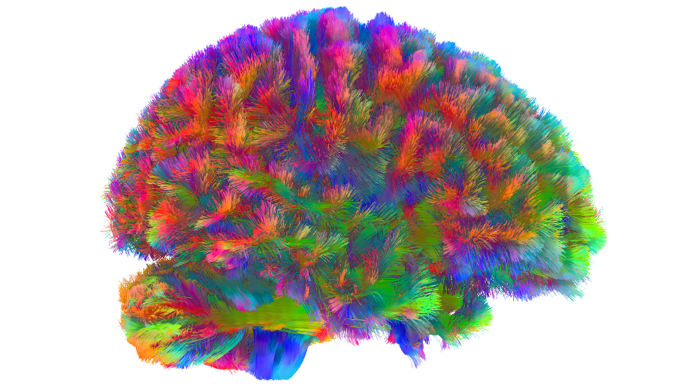 El cerebro entre los 66 y 83 años.