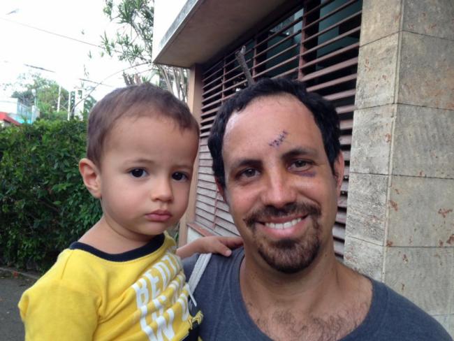 Oscar Casanella después de ser golpeado, con su hijo. 
