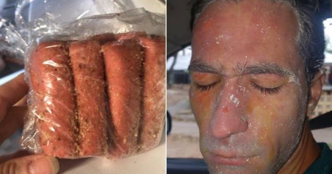 El paquete de croquetas y el rostro de la persona que sufrió las quemaduras.