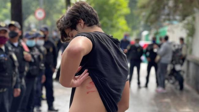 Un joven agredido por los defensores del régimen cubano en México.