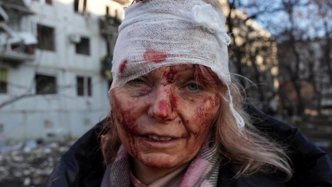 Una mujer ucraniana herida tras el ataque ruso.