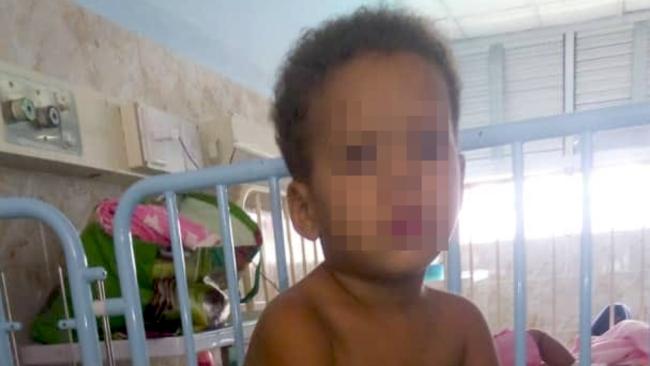 El niño de dos años de La Yine Yine, ingresado por diarreas.