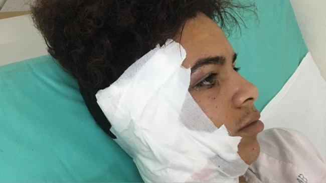 Marcos Herrera Falero, menor trans, víctima de un ataque en Matanzas.