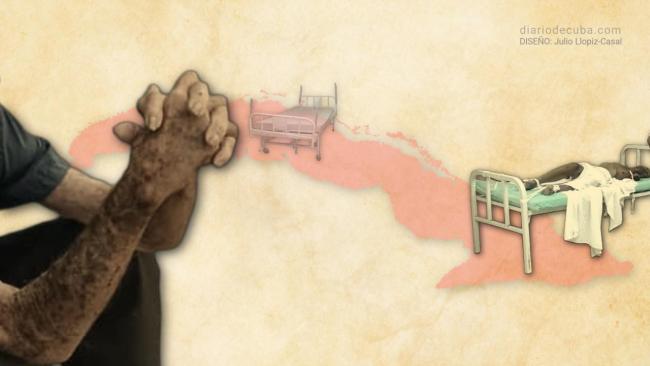 Cuidado paliativos en Cuba.
