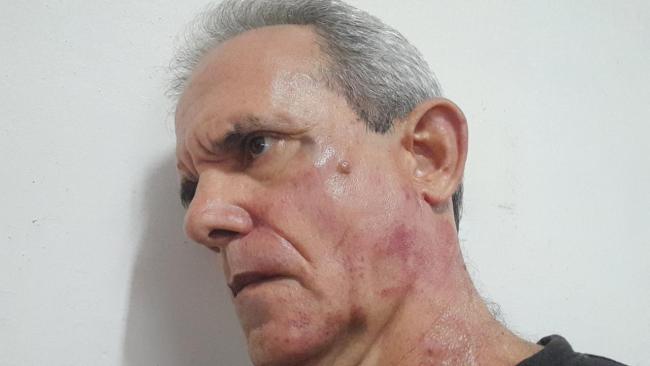 El escritor cubano Jorge Fernández Era tras ser golpeado por la Seguridad del Estado.