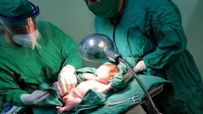 Médicos cubanos atienden un nacimiento.