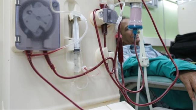 Una persona recibe tratamiento de hemodiálisis en Cuba.