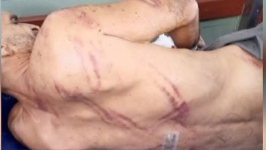 El preso Roberto Silva Arencibia tras la golpiza.