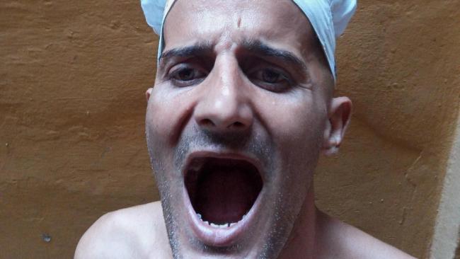 Yasmany González Valdés muestra la pérdida de parte de sus dientes sufrida en prisión.