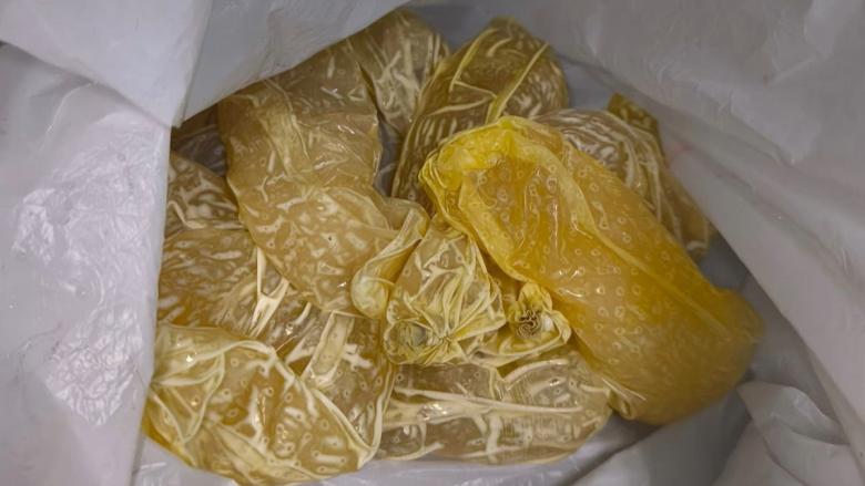 Cápsulas de droga que había ingerido el viajero descubierto en Cuba.