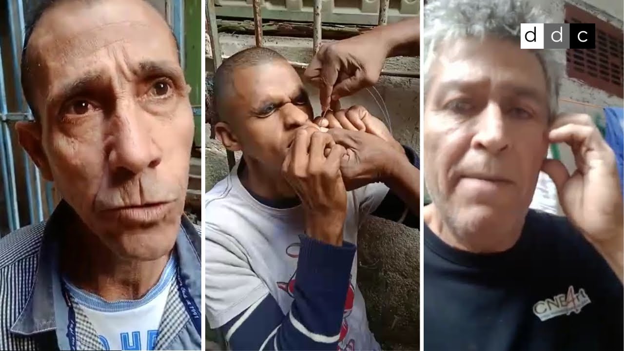 Un Exprisionero Político Cubano Se Cose La Boca En Protesta Contra El Acoso Del Régimen Diario 3111